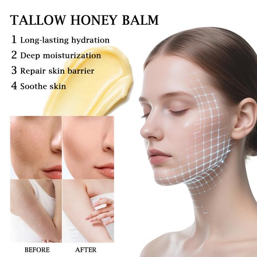 100% Grass Fed Whipped Beef Tallow Balm, Ultra Moisturizing Skin Cream for Face, Body Hands, Natural Skincare with Honey Coconut Oil Olive Oil and Avocado Oil for All Skin (1)