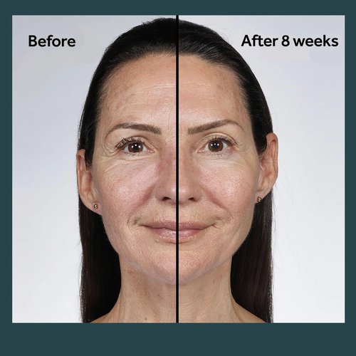 No7 Future Renew Damage Reversal Night Cream - Anti Aging Face Moisturizer - Infused with Peptide Technology to Reverse Visible Signs of Damage - Skin Barrier Repair for Dry Skin (1.69 Oz)