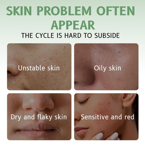 GROEI Centella Asiatica Intensive Hydration Cream, 85% Natural Ingredients, Long-Lasting Moisturizer for Sensitive Skin, 50g