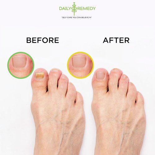DAILY REMEDY 4-Pack Foot Soak Set - 2 Extra Strength Tea Tree Oil & 2 Citrus Detox - Made In USA - Soothes Tired Feet, Athletes Foot, Stubborn Foot Odor, Softens Calluses & Refreshes & Detoxifies