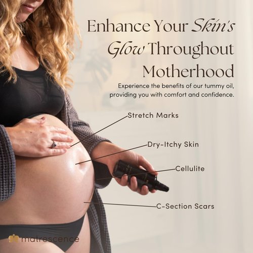Matrescence Stretch Mark Relief Belly Oil - Hydrating Spa-Quality Maternity Treatment | Pregnancy-Safe 3.4oz