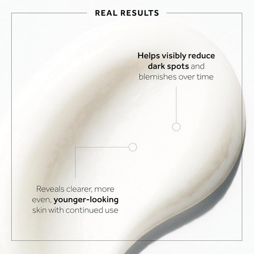 No7 Microdermabrasion Face Scrub - Exfoliating Dark Spot Corrector for Sensitive Skin | 2.5 Oz