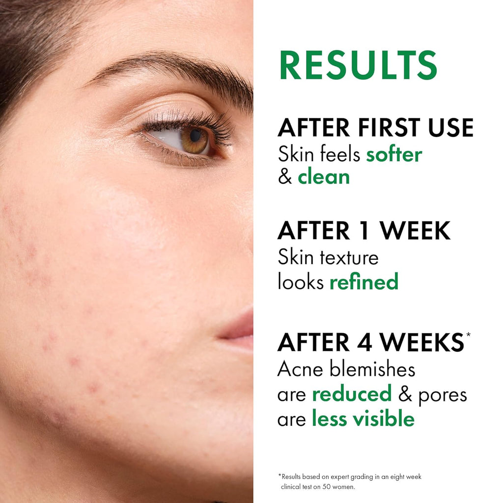 VICHY Normaderm Acne Control Daily Moisturizer - Oil-Free Formula with 2% Salicylic Acid & Vitamin C for Clear Skin
