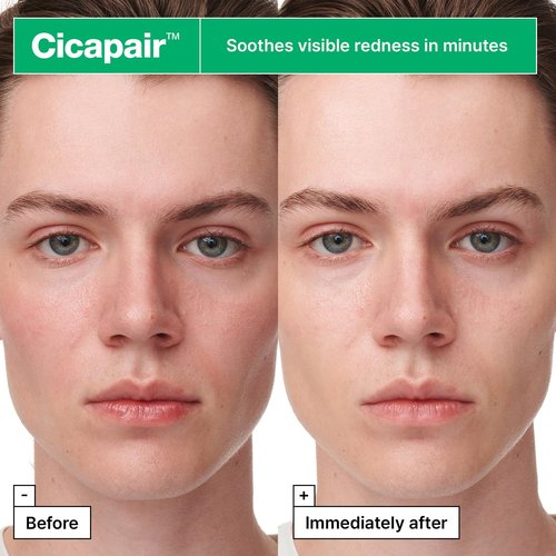 Dr.Jart+ Cicapair Sensitive Skin Serum Korean Face Mask for Redness with Centella Asiatica | Sheet Mask | Korean Skin Care, 5 Pack
