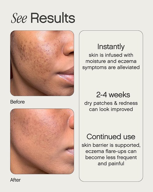Topicals Like Butter Moisturizer - Soothing Relief for Dry, Sensitive & Eczema-Prone Skin | Hydrating Face & Body Cream (1.7 Fl Oz)