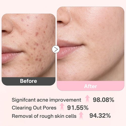Glycolic Acid 20% Resurfacing Pads - Exfoliating Peel Pads for Radiant Skin | 50 Count with Salicylic Acid & Vitamins E, B3, B5