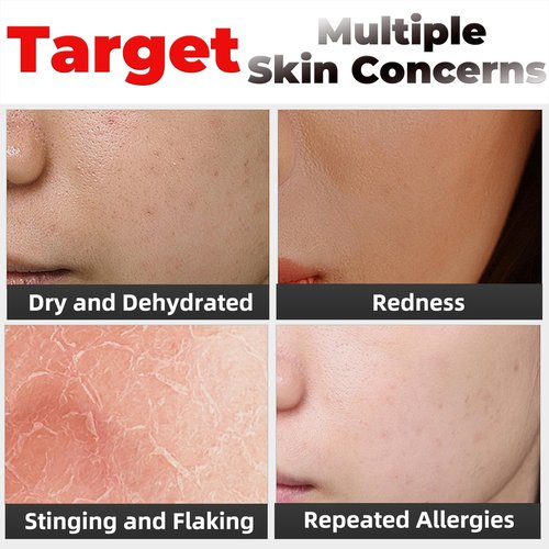 Elitzia Oxygen Facial Machine Oxygen Infusion Device Oxygen Sprayer Facial Nutrient Solution Set SPA Skincare Facial Machine Anti Aging Beauty Salon Machine 1.69fl.oz Per Bottle