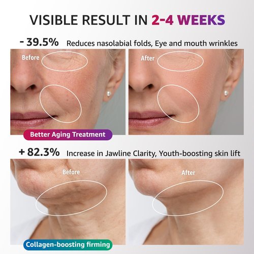 Red Light Therapy for Face and Neck, Renewal Face Lift Device with Vibration Tech, 3 in 1 Face Massager Tool with Thermals, True Beauty Glow Facial Sculptor for Wrinkles, Double Chin