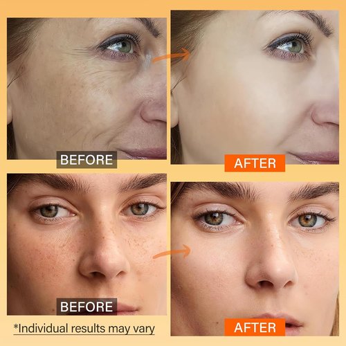 Regine Switzerland Vitamin C Face Moisturizer - Brightening Anti-Aging Cream with Turmeric & Niacinamide, 2.3 Oz