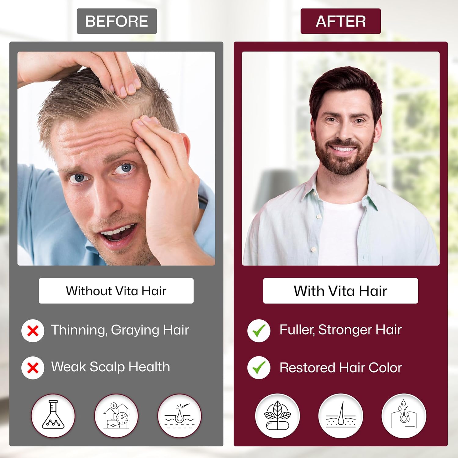 Vita Hair Growth Supplement - Micronized Formula for Healthier Hair - 100% Natural, 300 Capsules