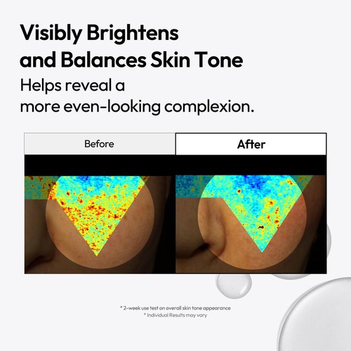 LAYERLAB Niacinamide 7% & Tranexamic Acid 3% Dark Spot Appearance Serum | 13% Radiance Complex Visibly Evens Skin Tone Look | Hydrating K-Beauty Skincare 0.94 fl.oz