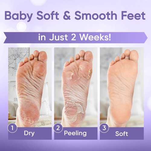 CÉLOR Foot Peeling Mask for Dry Cracked Feet | Foot Mask to Exfoliate Rough, Cracked, Dry Feet, Calluses for Soft Baby Feet Results | Made with Aloe Vera Extract for Women & Men (5 Pairs) | Lavender