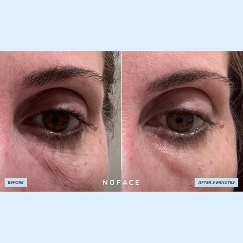 NuFACE IonPlex Hydra-Gel Under Eye Patches - Cooling Treatment for Puffy Eyes & Dark Circles | 60 Count