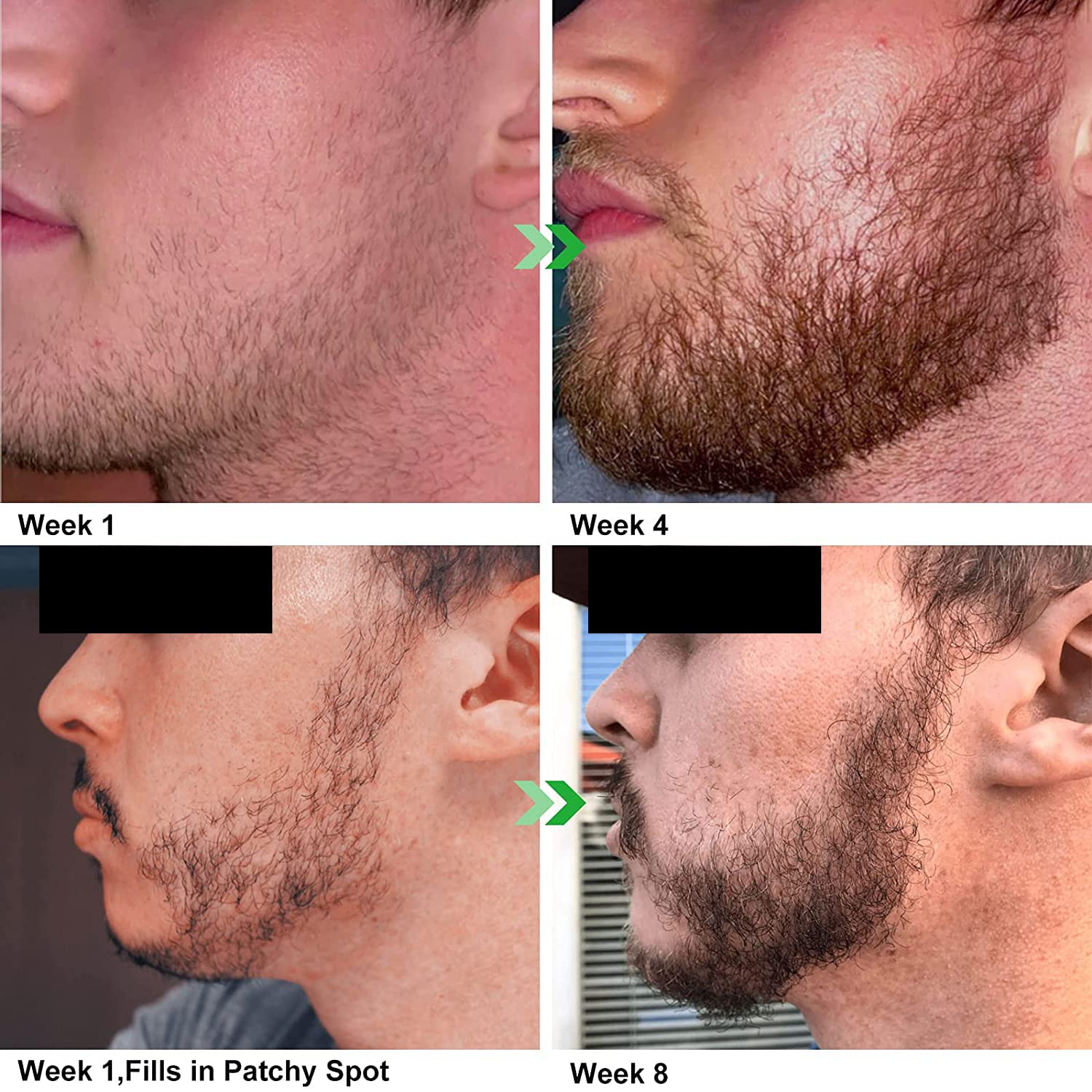 Unscented Beard Oil - Natural Hydrating & Conditioning Blend for Facial Hair - 32 oz | Promotes Growth & Silky Smoothness - Jojoba & Argan Oils