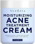 Ayadara Acne Cream - Moisturizing Salicylic Acid Face Moisturizer for Oily Skin | 90-Day Supply