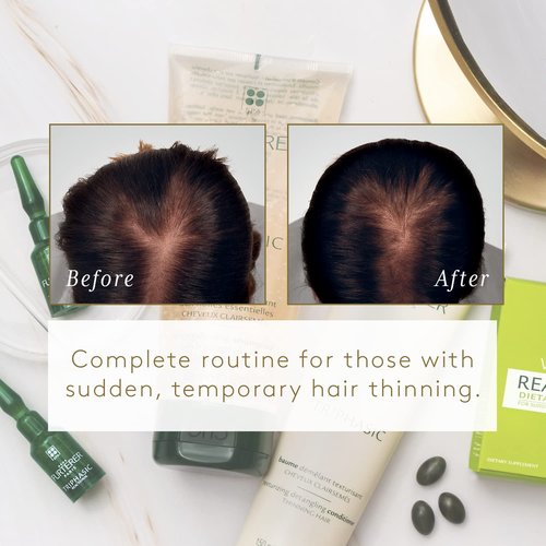 Rene Furterer Reactional Thinning Hair Ritual - Drug-Free Solution for Sudden Thinning Hair | 1 Ct.
