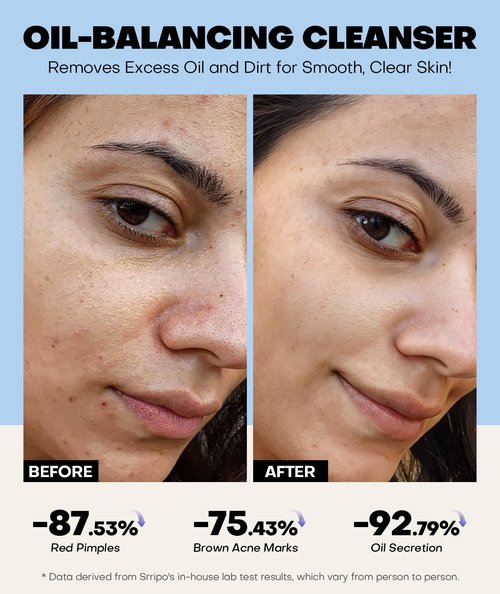 Ultra Gentle Foaming Face Wash with 13 Amino Acids, Deep Cleansing Facial Cleanser w/Brush Moisturizing & Non-Irritating Face Cleanser for Sensitive Dry All Skin, PH Balancing Oil Control Pore Cleaner
