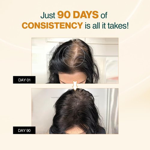 Nourish Mantra - Advanced Hair Growth Serum For Women & Men | Made With Redensyl, Anagain, Procapil & Rice Water | Prevents Hair Fall & Thinning | Promotes Hair Regrowth 25 ml