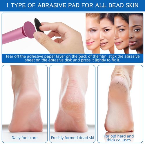 Electric Foot File - Callus Remover, Adjustable Speed, 60pcs Replacement Sandpaper Disks, Aluminum, Pink