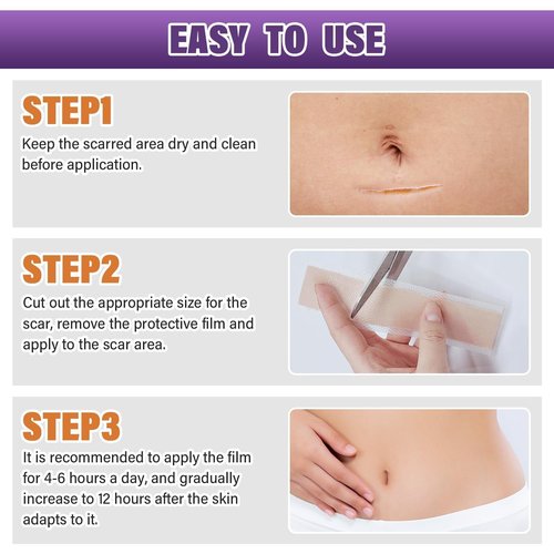 Silicone Scar Sheets,Silicone Scar Tape,Silicone Scar Removal Strips for Surgical,C-Section,Tummy Tuck,Keloid Scars (1.6"X 157" Roll-4M) Keloid Bump Removal