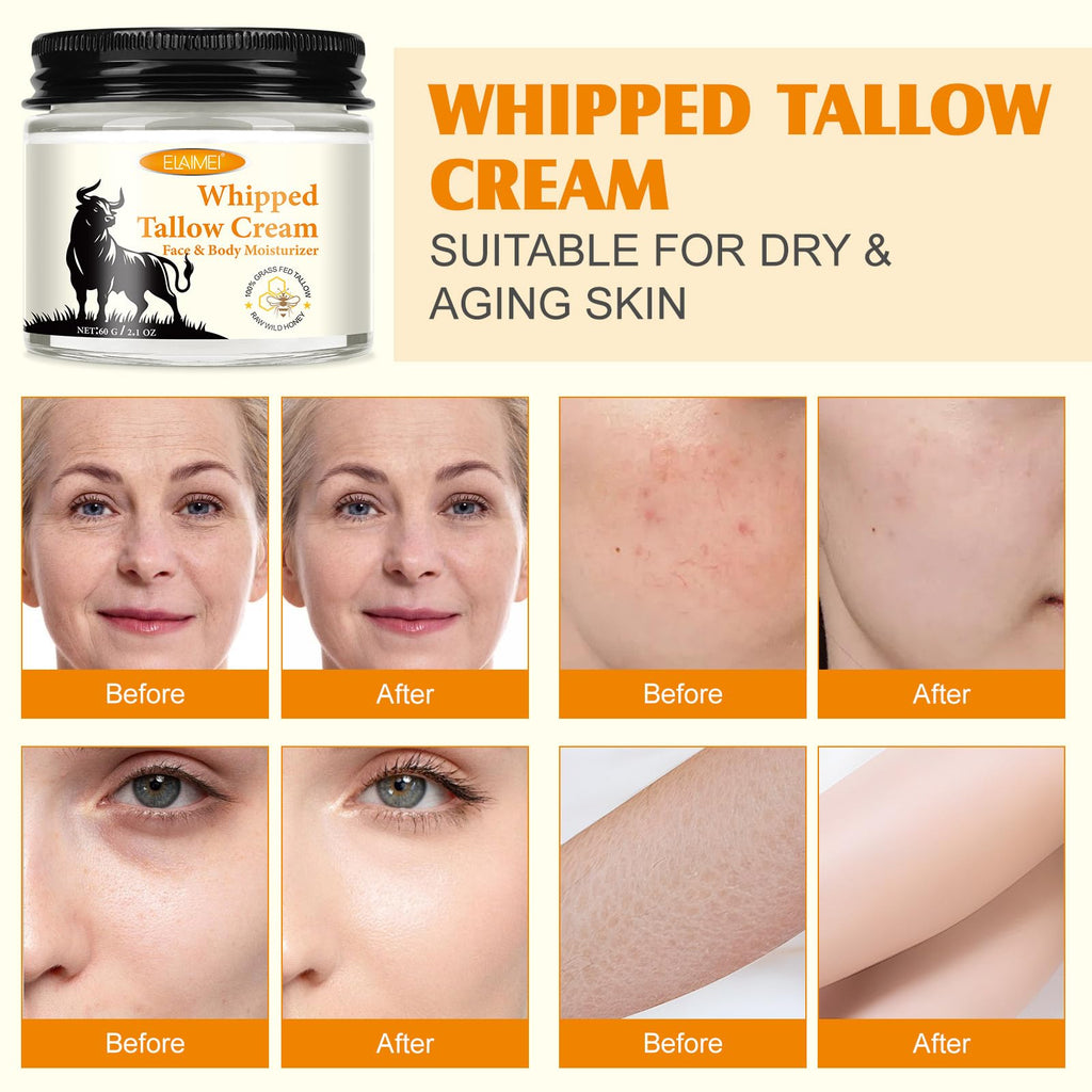 ZIXAOK Grass-Fed Tallow & Raw Honey Balm | Whipped Skin Cream for Face & Body | Soothes & Repairs Dry, Sensitive Skin | Organic, All-Natural Deep Hydration (2.1 oz)
