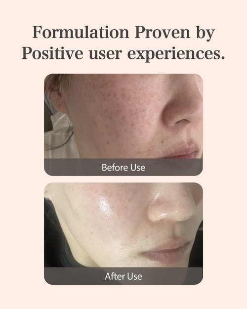 MASTINA Mastic Ampoule Serum (2-Pack, 0.5fl oz Each), Korean Face Serum with 63% Mastic Complex & Niacinamide for Firming & Hydrating, Great Value Pack