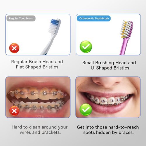 JTF Orthodontic Manual Toothbrush for Braces: 6 U-Shaped Tooth Brush with 6 Interdental Brushes, Ultra-Durable Bristles for Stain Removal and Deep Oral Clean, Toothbrushes for Tooth with Dental Device