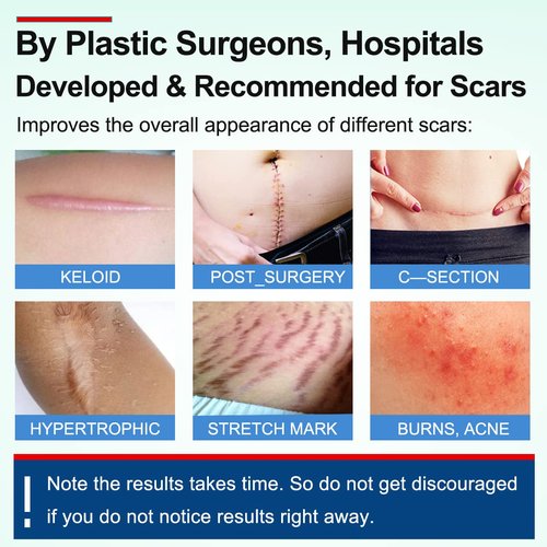 Silicone Scar Sheets Tape for Surgical Scars, C Section Scar Silicone Strips, Medical Grade, Reusable, Soften and Flattens Scars, Breast, Keloid, Professional Scar Patches. (1.6x115 Inch)