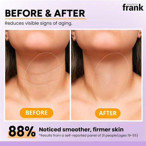 Excuse My Frank - Bakuchiol Age Defense Face & Neck Cream | Reduces Puffiness & Fine Lines (2 Pack)