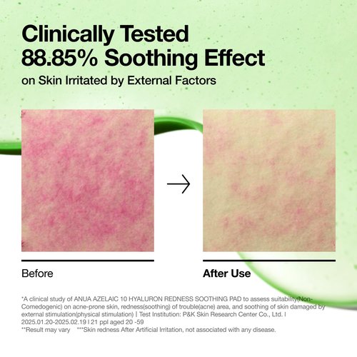 ANUA Azelaic 10 Hyaluron Redness Soothing Pad, Troubled & Spot Care, Quick & Easy Stretchable Facial Mask with Azelaic acid, Hyaluronic Acid, Korean Skincare (90 pads)