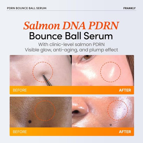 FRANKLY Salmon PDRN Bounce Ball Serum - 99% Pure Salmon DNA for Skin Recovery & Repair | Lightweight, Non-Sticky | 1.01 fl oz