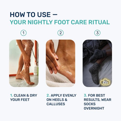 PROJECT 701 Urea Cream 40 Percent for Feet Maximum Strength, Callus Remover Foot Cream, Dry Cracked Heels Exfoliating Lotion with Salicylic Acid, Ceramides, Tea Tree Oil – Women and Men, 4.3 oz