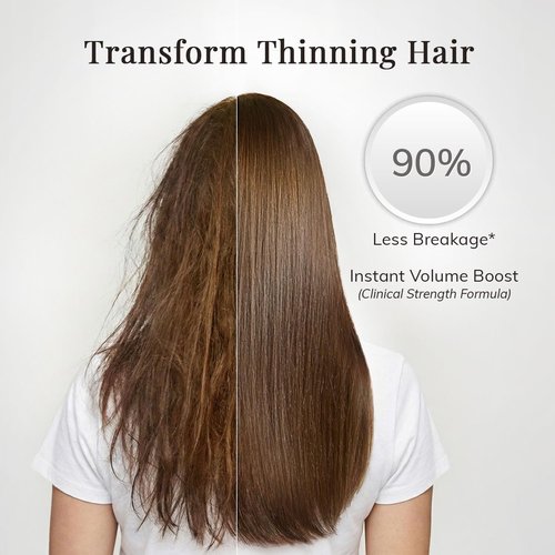 RootStim Rosemary Conditioner - Volumizing Hair Growth Treatment with Saw Palmetto & Keratin | 10 fl oz