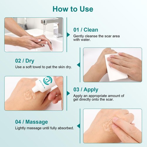 Scar Cream Silicone Scar Gel, Powerful Scar Removal Cream for Old & New Scars, Helps Reduce Surgical Scars, Acne, Burn, Keloids & Stretch Marks, 1.76 oz (50g)