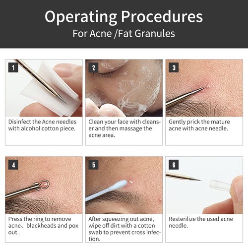 Blackhead Remover Tools,Upgrade 8 PCS Acne Needles,GERY Whitehead Removal Extractor Pimple Popper Kit, Professional Stainless Pimple Blemish and Pore Cleaner Set with Leather Package