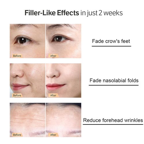 Regine Switzerland Deep Collagen Anti-Wrinkle Serum - 30ml Hyaluronic Acid for Soft, Smooth Skin