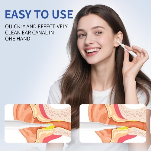 Ear Wax Removal Tool, Multifunctional Spiral Ear Cleaner, Q Grips Earwax Cleaning Tool with 9 Replacement Tips, Washable Ear Wax Removal Kit for Deep Cleaning Ear Picks