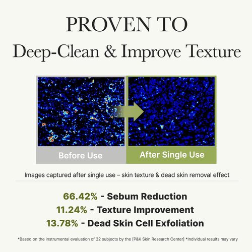 ARENCIA Salicylic Acid Cleanser - Deep Pore Cleansing Face Wash with Green Tea & LHA, 5.07 fl oz