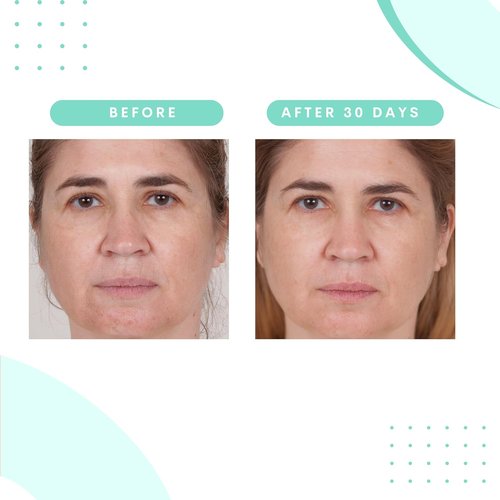 Serious Skincare Glycolic Acid Treatment Pads - Exfoliating Face Discs with Vitamin E & Aloe | 2 Pack (60 Pads Each)