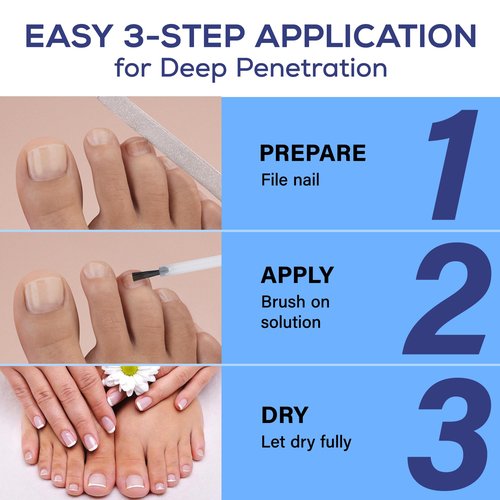 PHARMBANNER Toenail Fungus Treatment Extra Strength: 25% Undecylenic Acid Toe & Fingernail Fungus Renewal - Nail Fungus Treatment Kit with Brush & File - For Ingrown Nails & Discoloration