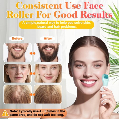Derma Roller Set - UUPAS 10 in 1 Microneedling Roller Kit for Face, Body, Hair, Beard and Scalp - Ice Face Rollers for Women and Men with Storage Case