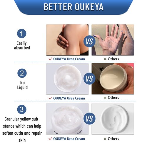 OUKEYA Urea Cream 40 Percent,Foot & Hand Cream for Dry Cracked,Urea Lotion for Feet Maximum Strength(2 Packs)