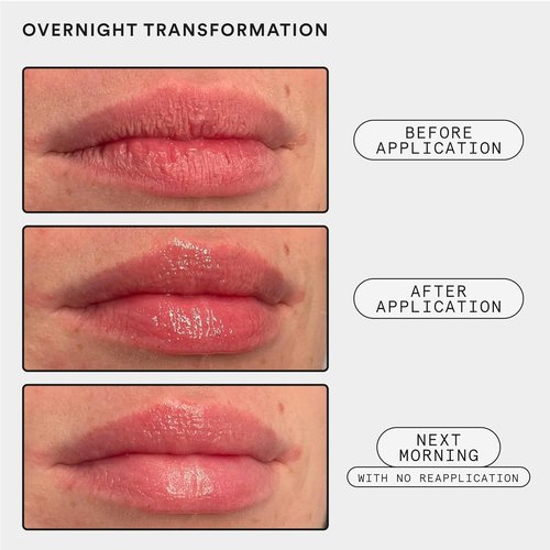Experiment Softwear Lip Treatment Balm - 24HR Hydration with Squalane & Glycerin - Vegan Formula for Extra Dry Lips | 0.34 FL OZ