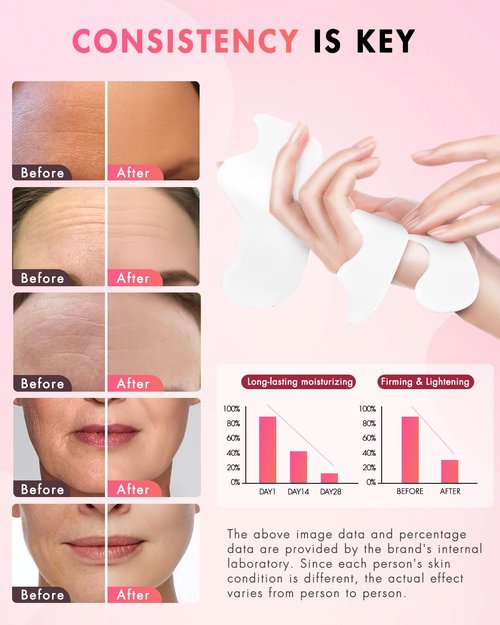 UKVOA Facial Forehead Wrinkle Patches and Smile Line Patches, Overnight Anti Aging Lifting Treatment with Hyaluronic Acid Aloe Collagen and Vitamin E for Women 36pcs