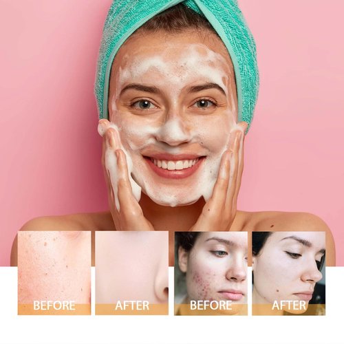 Axnzp 2 Pcs Turmeric Foaming Face Wash With Brush, Deep Cleansing Exfoliating Glow Wash Turmeric Facial Cleanser for Women All Skin. ﻿