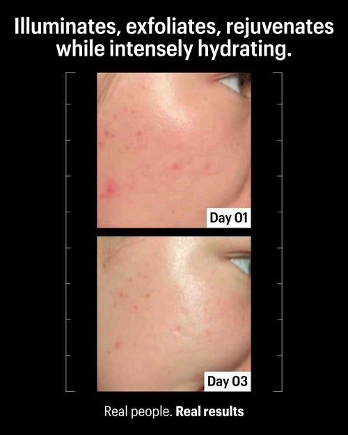 Allies of Skin Multi Acids & Retinoid Sleeping Facial | Exfoliating Overnight Glycolic Acid & AHA Peel | Resurfacing Anti-Aging Treatment For Fine Lines | Unclog Pores and Treat Blackheads 1.6 fl oz