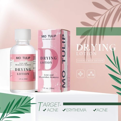 MO TULIP Acne Drying Lotion - Overnight Spot Treatment for Face & Body, 1oz Pimple & Blemish Solution