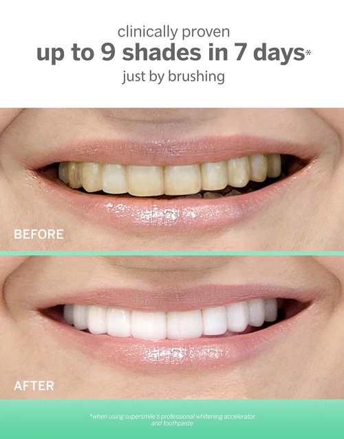 Supersmile Extra White Teeth Whitening System - 2 Count Pack for Bright, Radiant Smile
