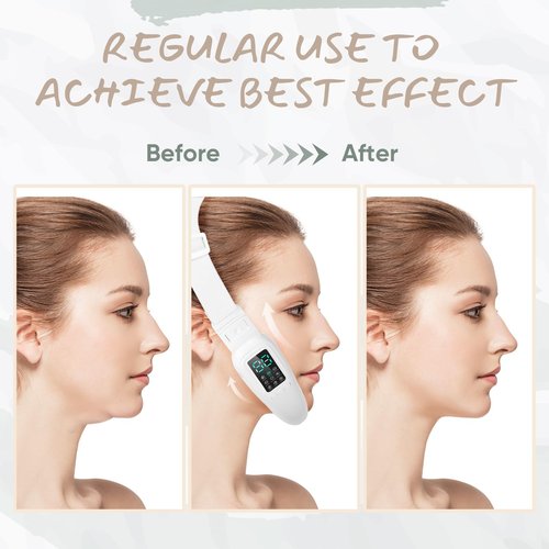 V-Face Electric Double Chin Device with 8 Modes & 15 Gear Adjustable Intensities - Intelligent V-Face Machine for Contouring Double Chin - White