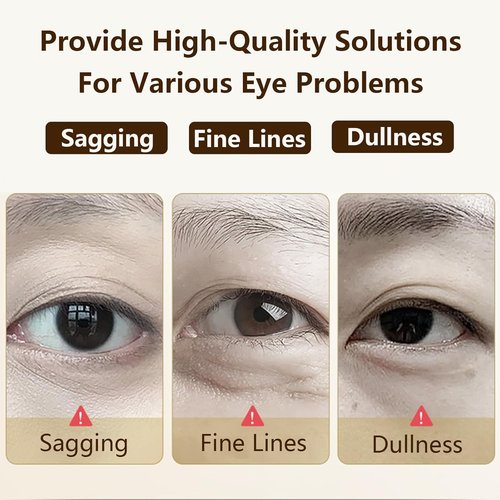 Skiennix Eye Repair Stick for Men - Caffeine Under Eye Roller for Dark Circles & Puffiness, 0.34 Fl Oz